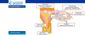 hysteroscopy unexplained infertility