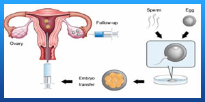 How many days after period is frozen embryo transfer?