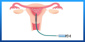 iui with injectables success rates