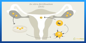 what's the difference between icsi and ivf 