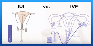 iui vs ivf