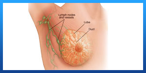 stage 2 breast cancer treatment timeline