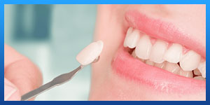 Are dental veneers permanent?