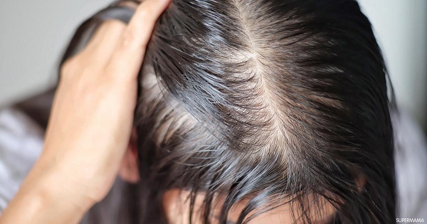متى تثبت البصيلات بعد زراعة الشعر؟