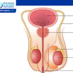 Testicular Disorders