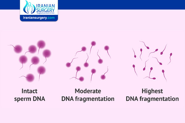 How to Test for Sperm DNA Fragmentation?