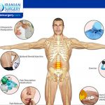 علاج فقرات الظهر بدون جراحة