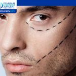 عمليات التجميل للرجال