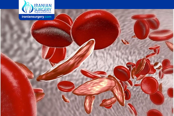 Sickle Cell Anemia (Sickle Cell Disease)