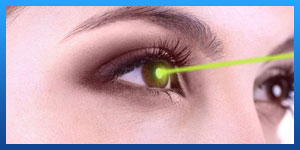 Epi-Lasik Surgery