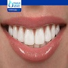 Do Your Teeth Rot Under Veneers?