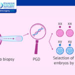 What Is the Purpose of PGD?