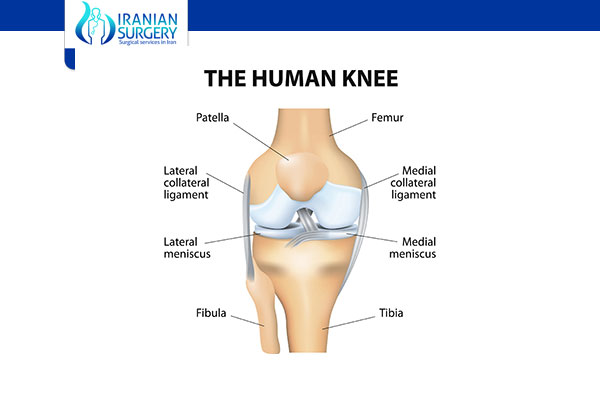Meniscus Surgery