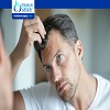 What is the Best Age for Getting a Hair Transplant?
