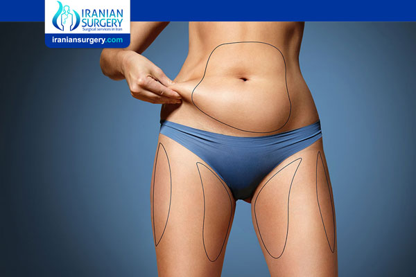 Uneven Weight Gain After Liposuction