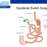 Duodenal Switch Revision