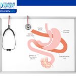 Nutrition Guide to SADI-S Surgery