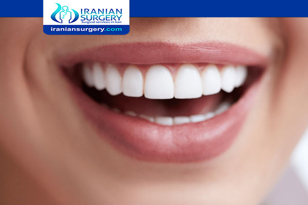 The Cost of Dental Composite in Iran