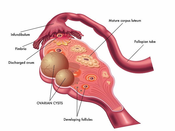 Functional cysts