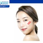 Cheekbone Reduction Surgery