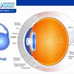 Cataract Surgery Lens Options