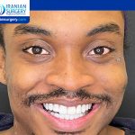 Satisfactory results of 4 specialized surgeries performed on an English patient