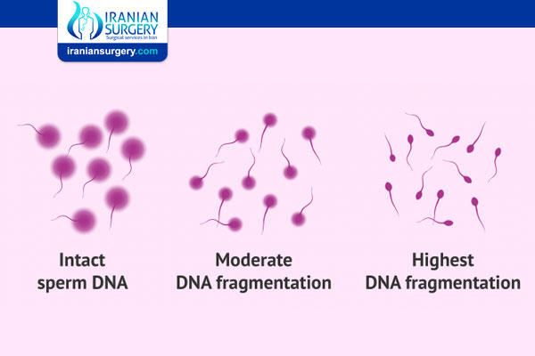 Sperm DNA Fragmentation Test Procedure