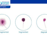 DNA Fragmentation Index