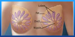 عملية تصغير الثدي والسرطان