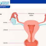 Pelvic Inflammatory Disease (PID)