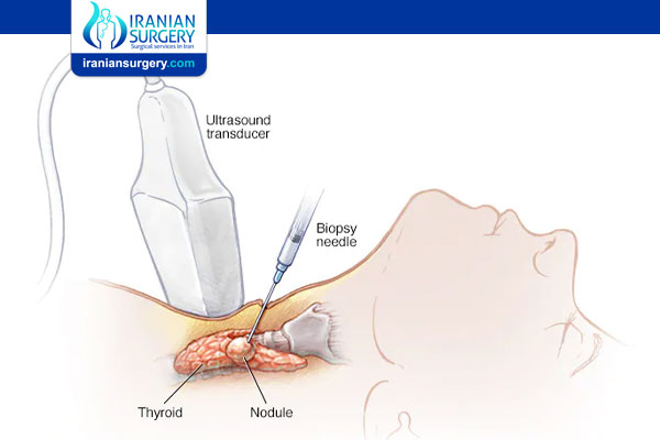 Needle Biopsy