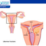 Uterine Factor Infertility