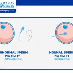 What is the Normal Motility of Sperm?