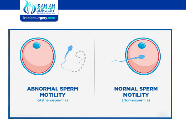 What is the Normal Motility of Sperm?
