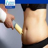 Is VASER Lipo Better Than Traditional Lipo?