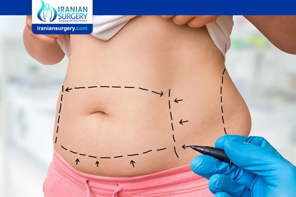 How to Treat Liposuction Scars