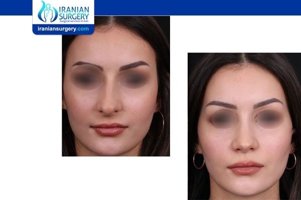 Advertise With Iranian Surgery
