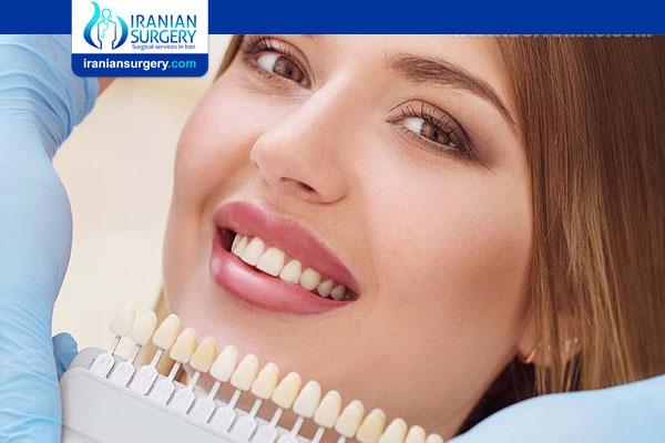 Cost of Dental Laminate in Iran by details