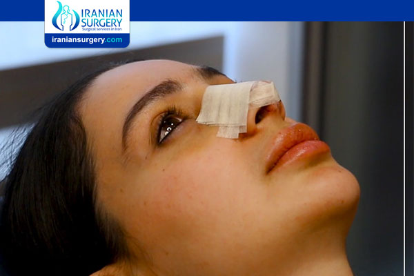 After Rhinoplasty Surgery in Iran
