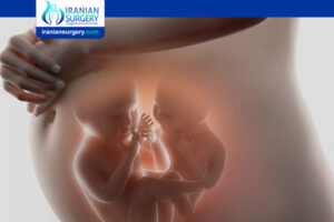 Twin Pregnancy Symptoms at 32 Weeks