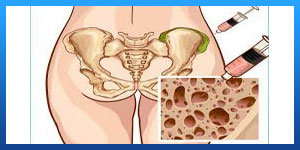 Bone Marrow Transplant in Iran