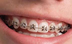 ما هي افضل عيادة اسنان في شيراز؟
