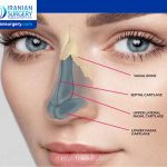 How Long Does the Pain Last After Rhinoplasty?