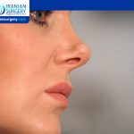 Can Your Nose Collapse Years After Rhinoplasty?