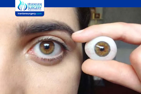 Ocular Prosthesis or Prosthetic eyes
