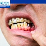 Dental Implant Pain Years Later