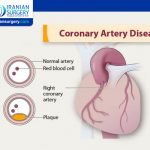 Coronary Artery Disease Diagnosis