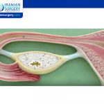 علاج ضعف المبايض