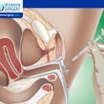 Intrauterine Insemination (IUI) Success Rates