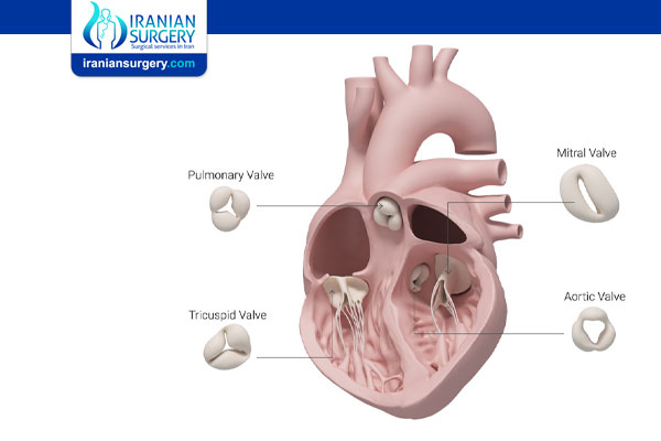Types Of Heart Valve Replacement